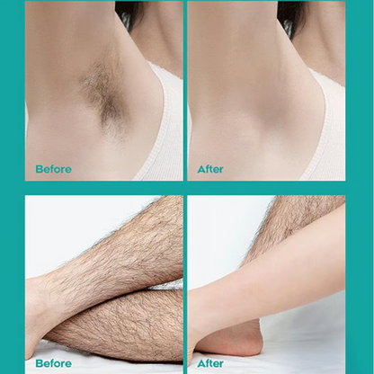 🎁Painless Full Body Hair Removal Cream 💧✨（The more you buy, the higher the discount）